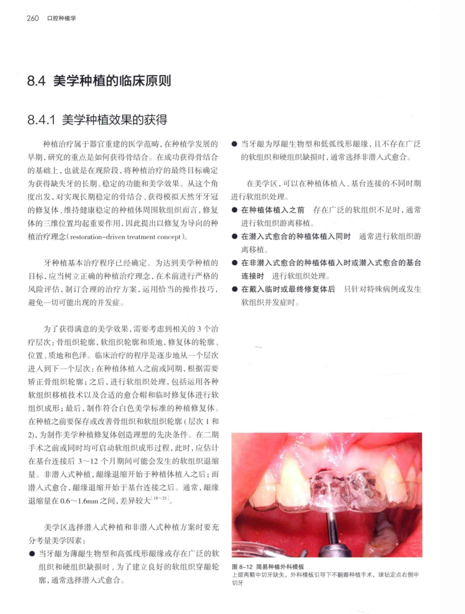 口腔种植学（第2版）_宿玉成主编_2014年（彩图）_301-330.pdf_第3页