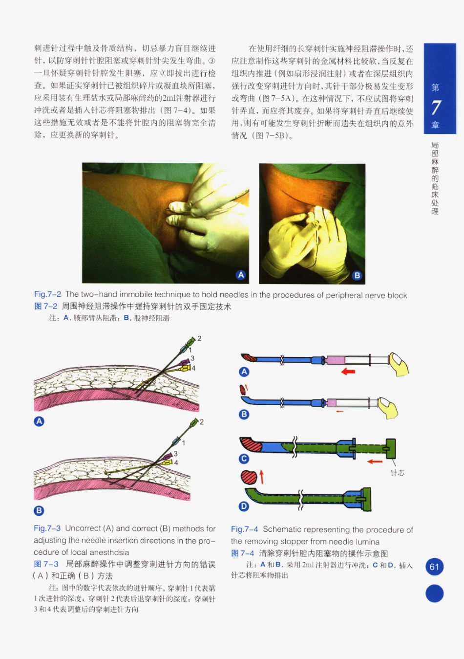 临床局部麻醉技术_76-100.pdf_第1页