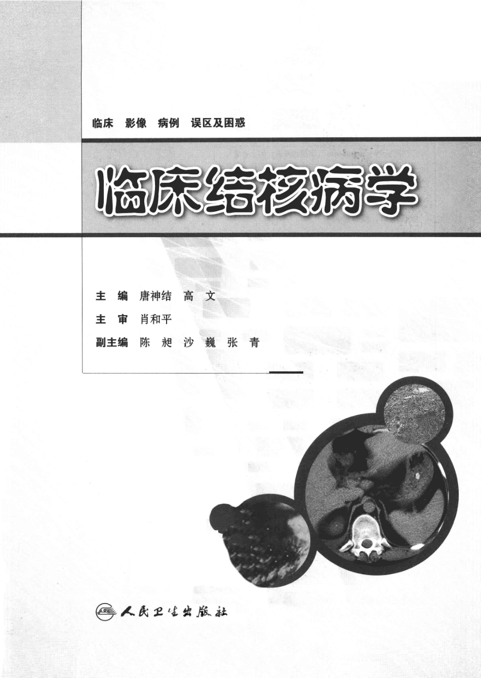 临床结核病学 （临床、影像、病例、误区及_13008036_1-25.pdf_第3页