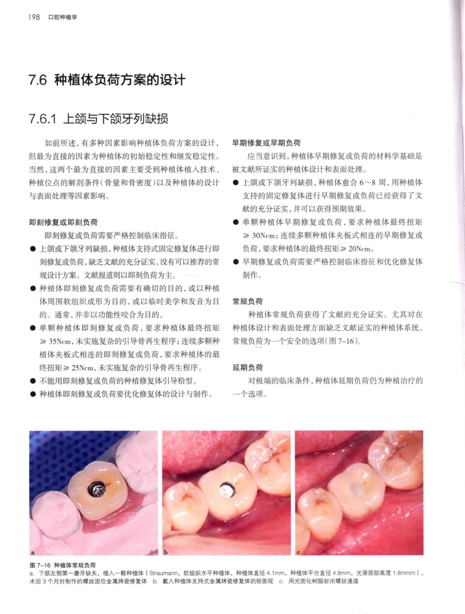 口腔种植学（第2版）_宿玉成主编_2014年（彩图）_241-270.pdf_第1页
