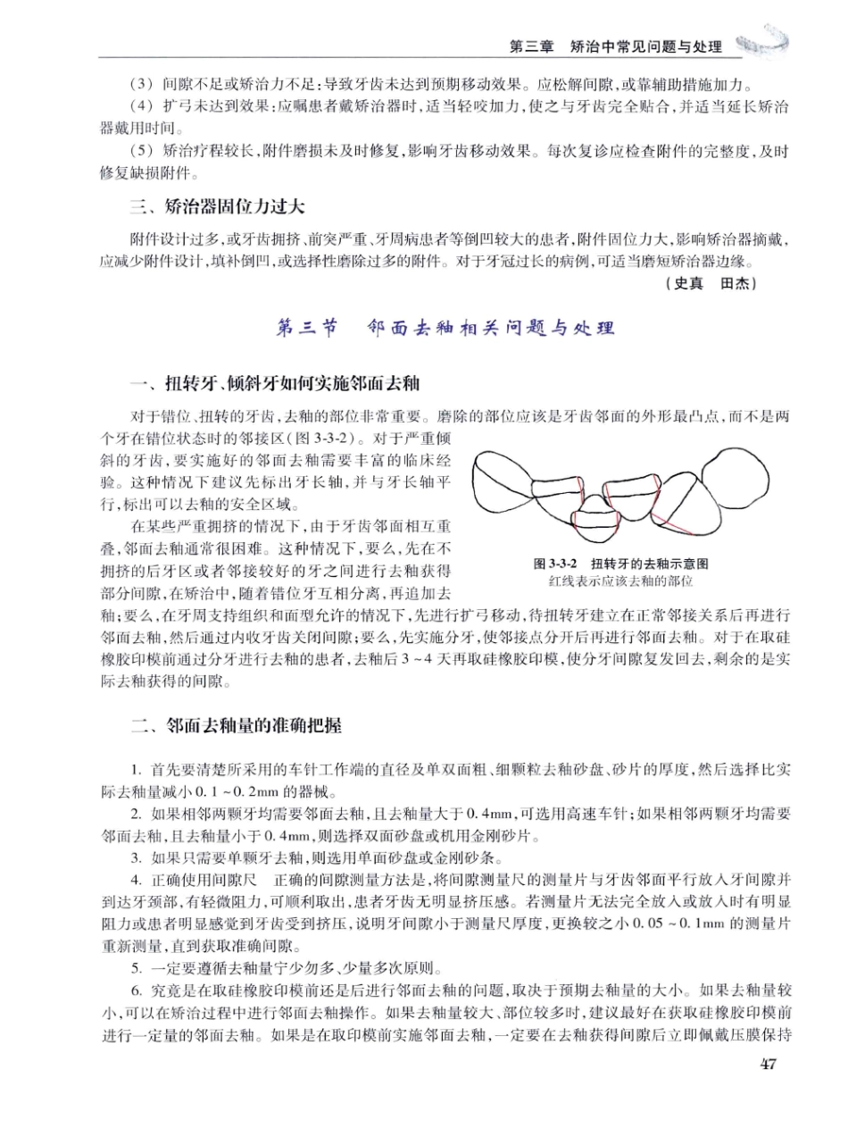 口腔正畸现代无托槽隐形矫治技术 田杰著 2014_61-72.pdf_第1页