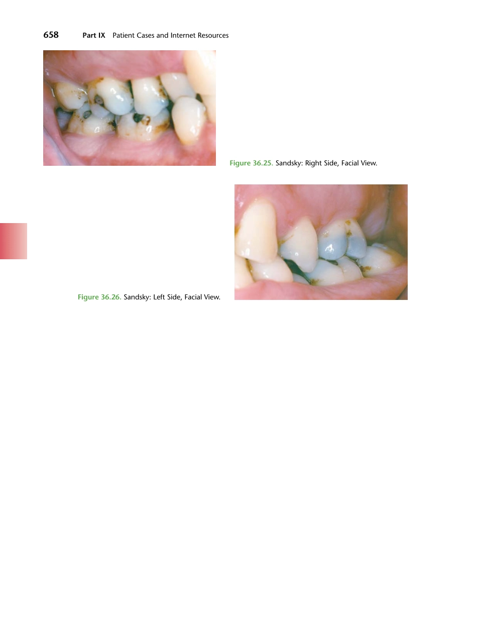 牙周2012Foundations of Periodontics for the Dental Hygienist _676-700.pdf_第1页