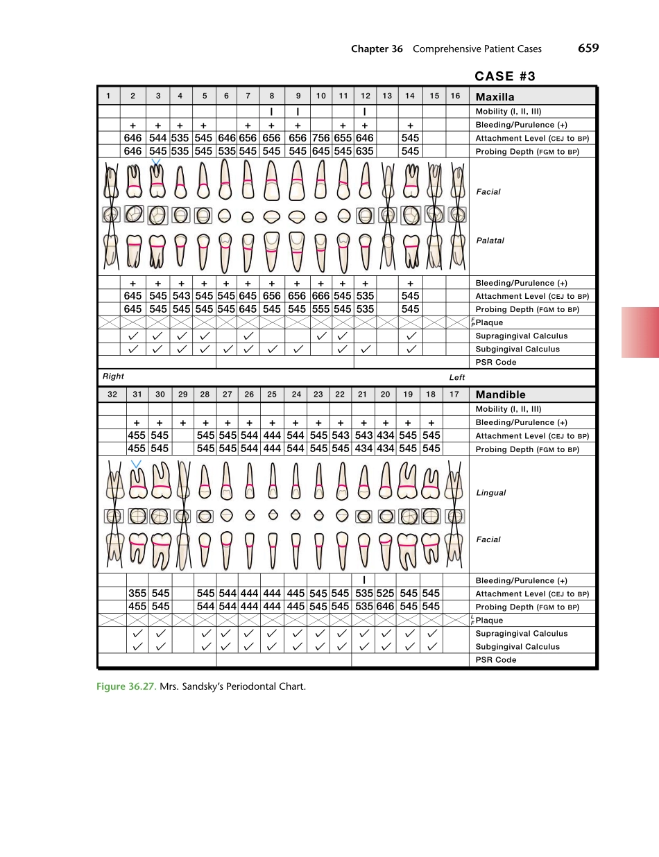 牙周2012Foundations of Periodontics for the Dental Hygienist _676-700.pdf_第2页