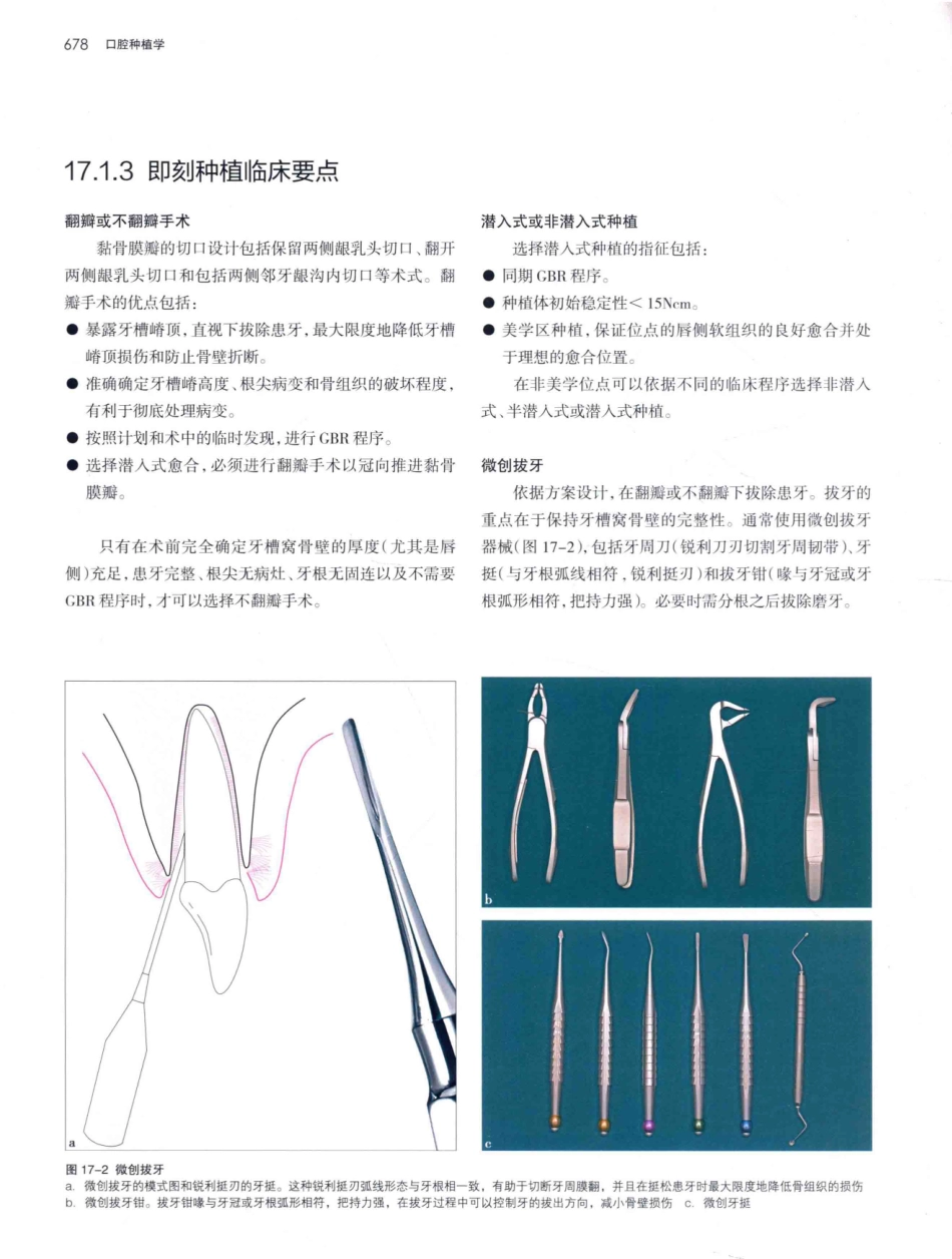 口腔种植学（第2版）_宿玉成主编_2014年（彩图）_721-750.pdf_第1页