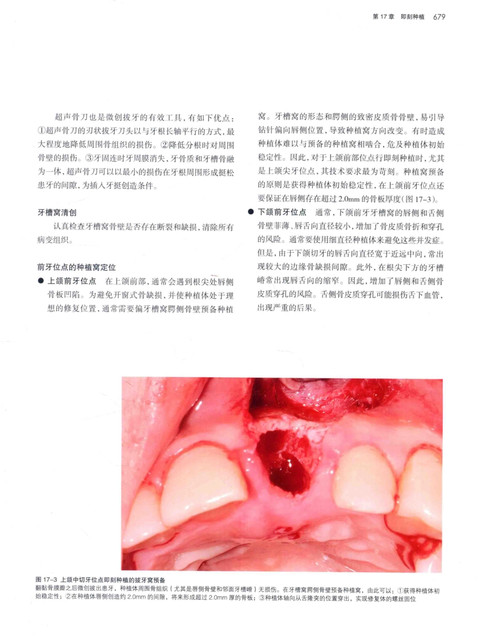 口腔种植学（第2版）_宿玉成主编_2014年（彩图）_721-750.pdf_第2页