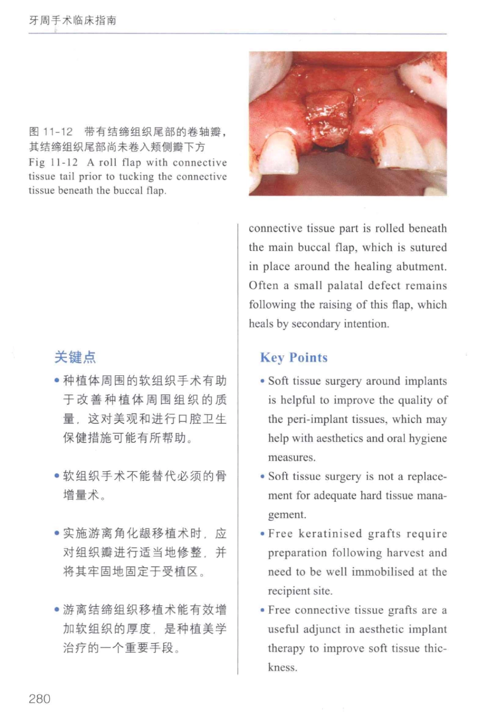 牙周手术临床指南 中英文对照_俞雪芬2013（彩图）_289-291.pdf_第2页