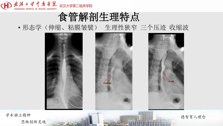 医学学科：(5.7.1)--食管癌影像学诊断.pdf_第3页