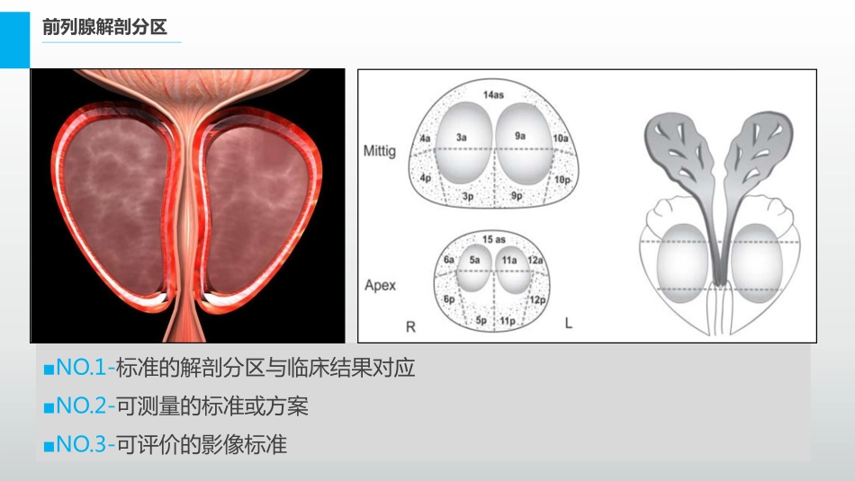 医学学科：(6.3.1)--前列腺癌的影像学诊断.pdf_第3页