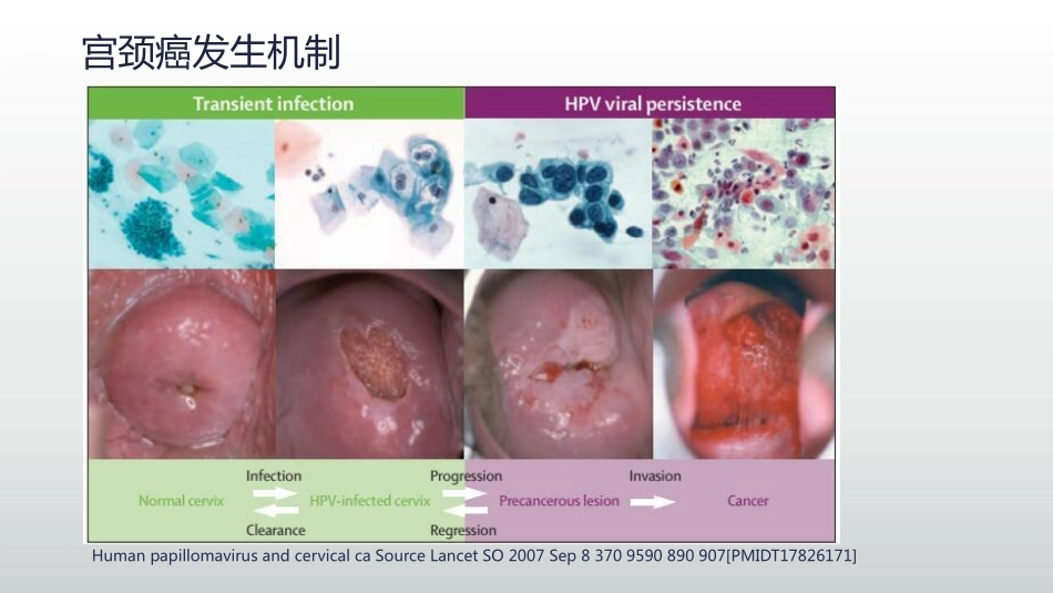 医学学科：(7.1.1)--宫颈癌影像学诊断.pdf_第2页