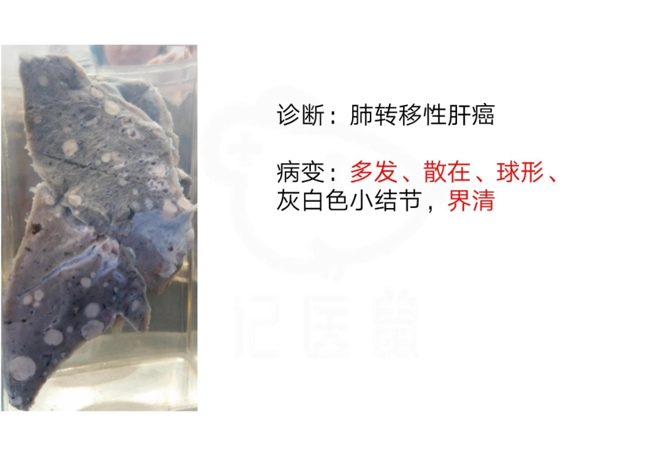 医学学科：病理学--实验考试图片.pdf_第2页