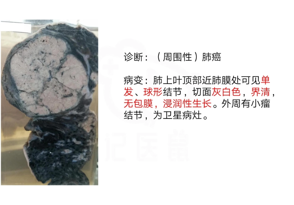 医学学科：病理学--实验考试图片.pdf_第3页
