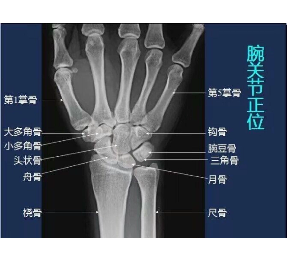 医学学科：骨骼系统X线影像图谱.pdf_第1页