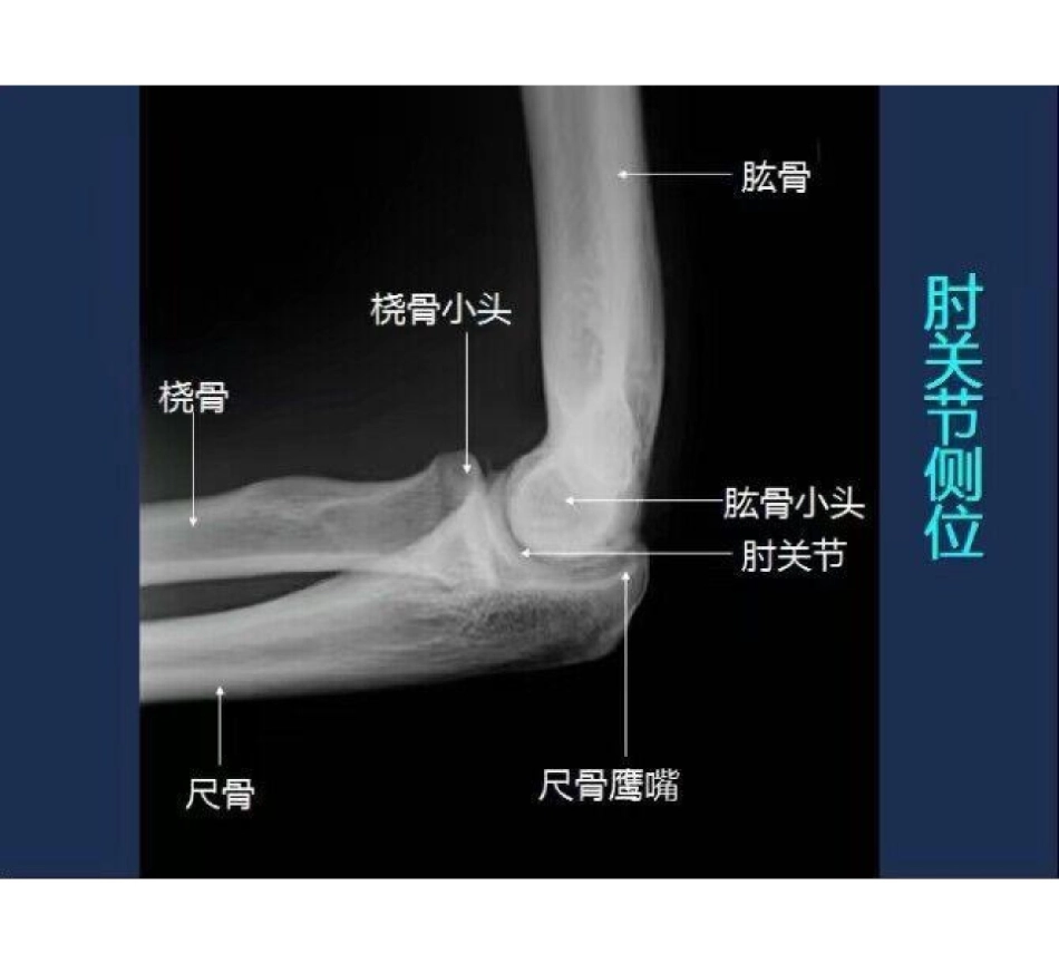 医学学科：骨骼系统X线影像图谱.pdf_第2页