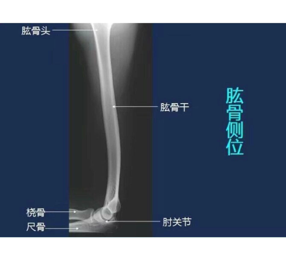 医学学科：骨骼系统X线影像图谱.pdf_第3页