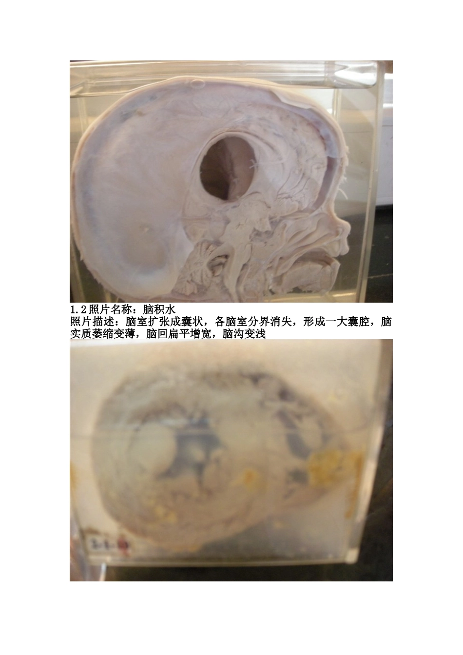 医学学科：考试标本1.doc_第2页
