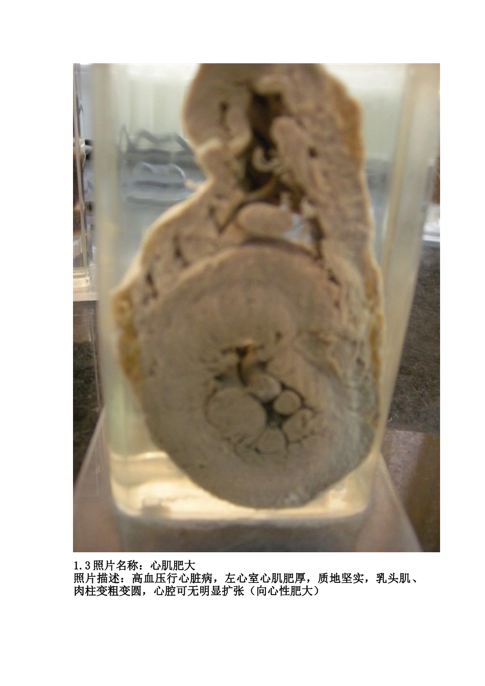 医学学科：考试标本1.doc_第3页