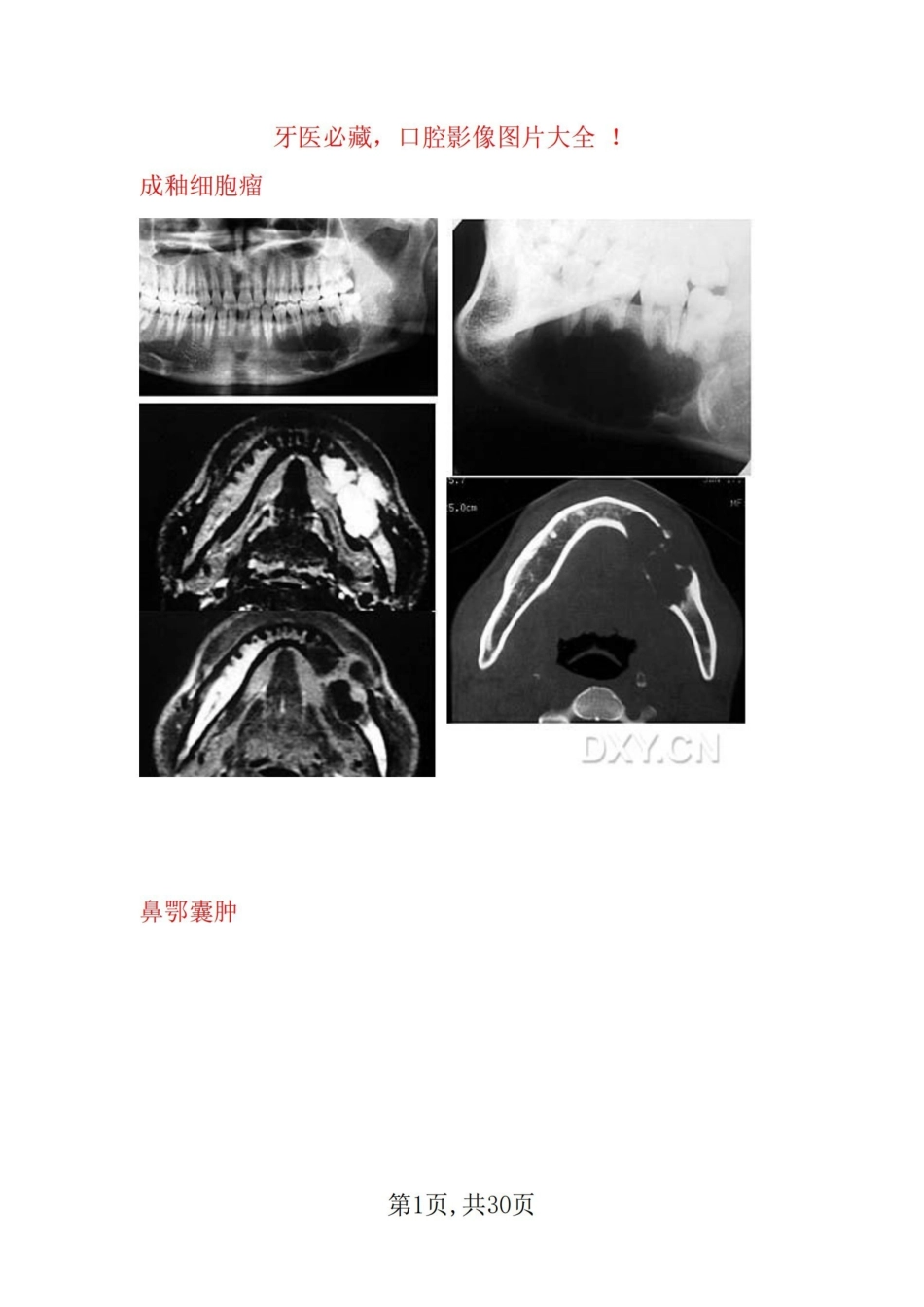 医学学科：口腔影像--图片大全.pdf_第1页