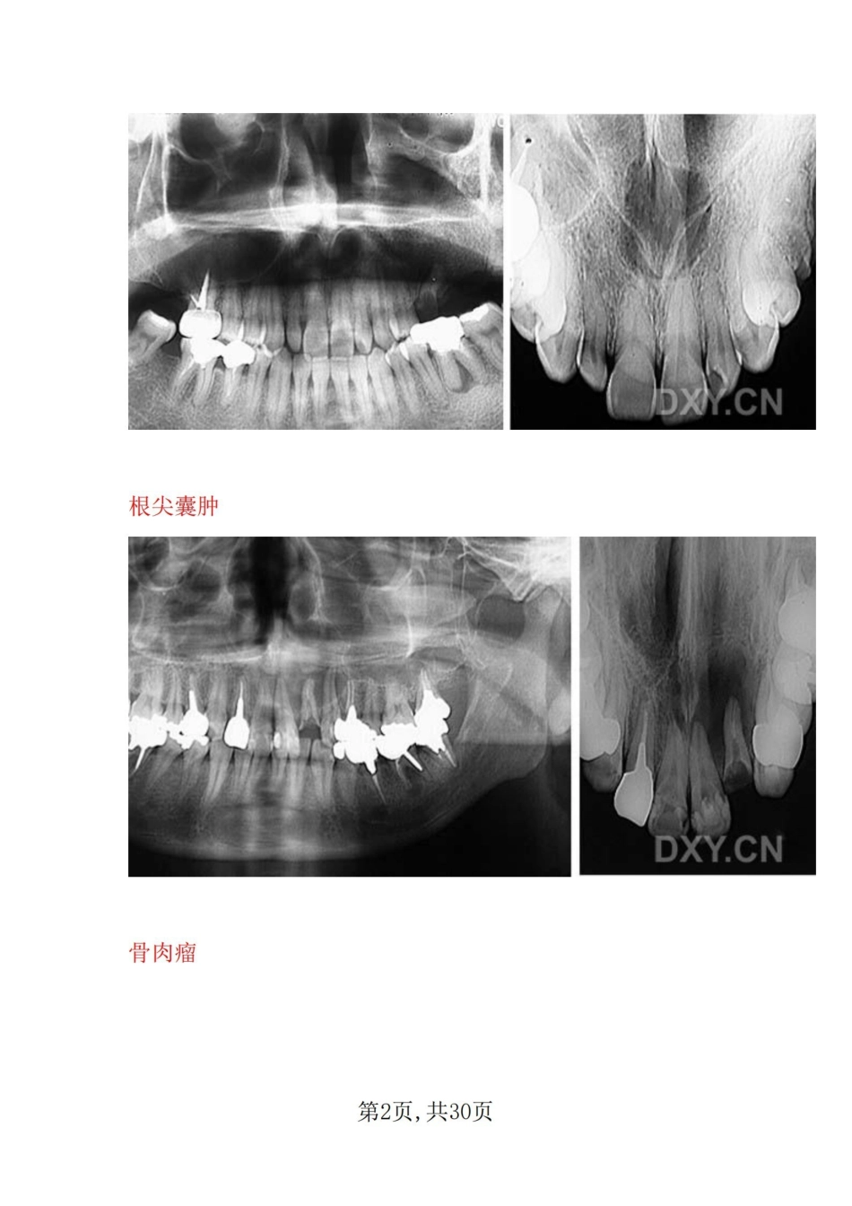 医学学科：口腔影像--图片大全.pdf_第2页