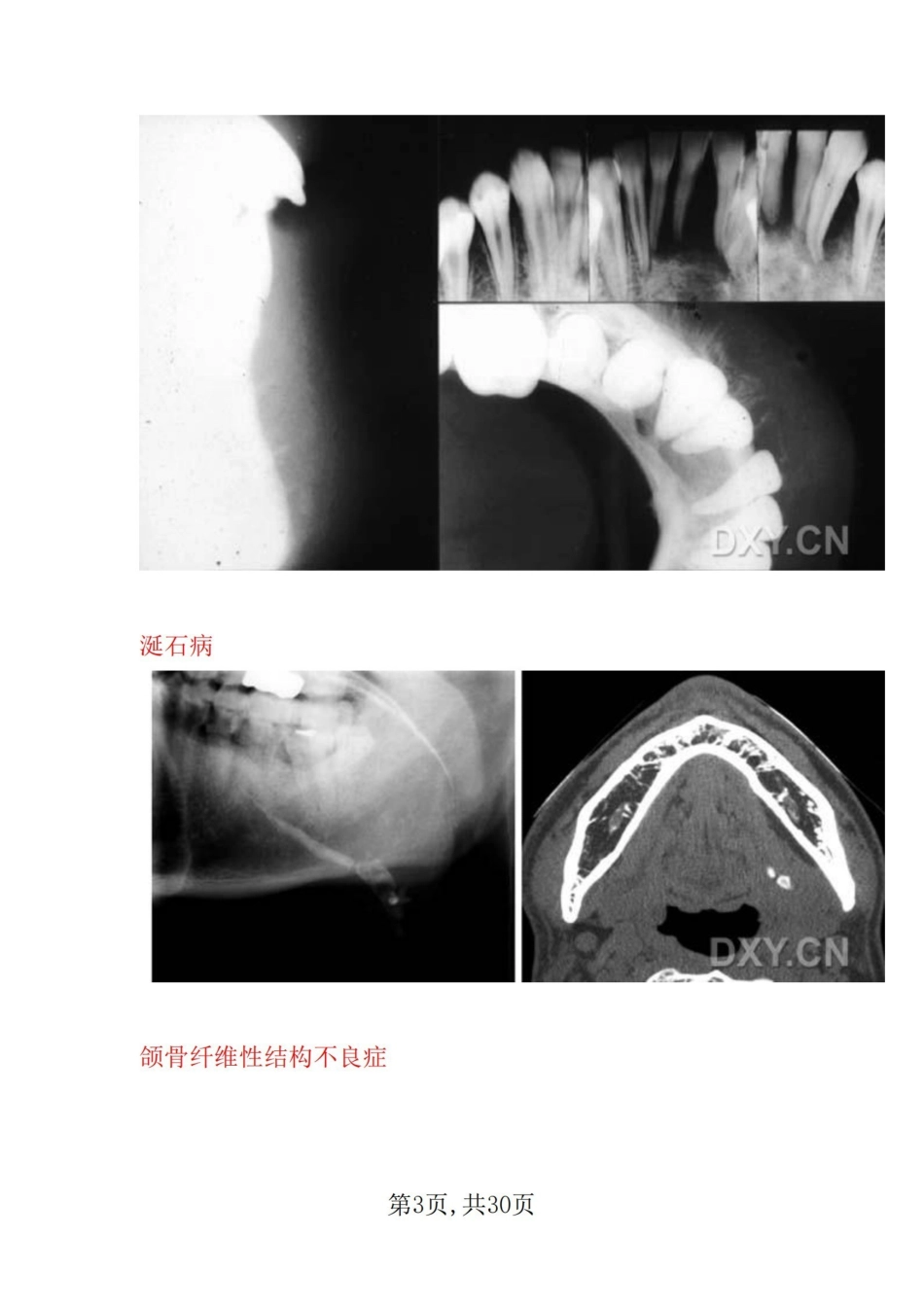 医学学科：口腔影像--图片大全.pdf_第3页