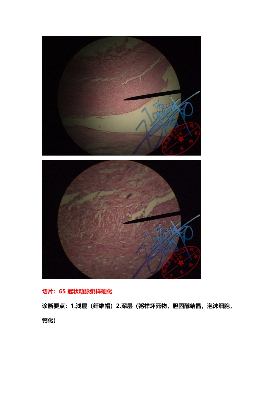医学学科：切片标本.doc_第2页