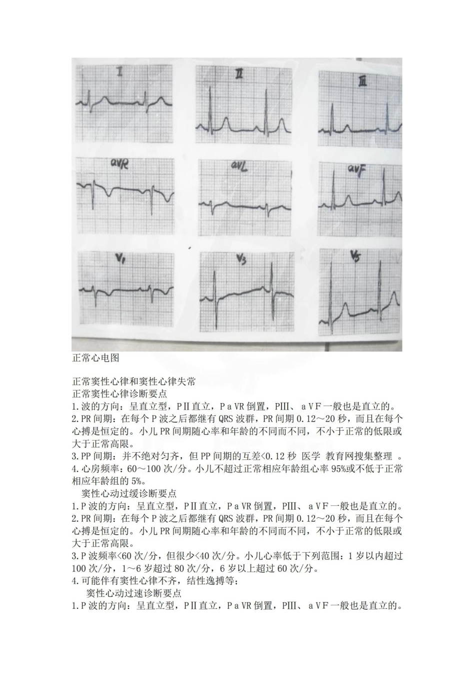 医学学科：心电图考试--图片及详解.pdf_第1页