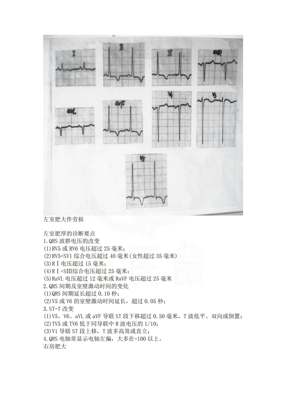 医学学科：心电图考试--图片及详解.pdf_第3页