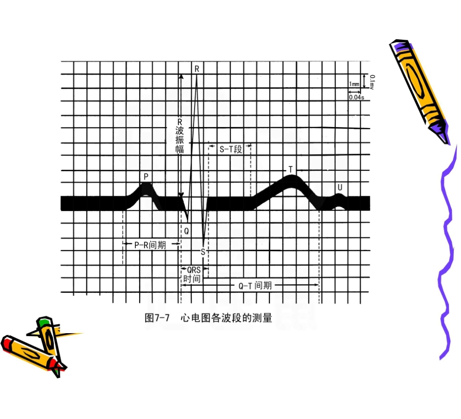 医学学科：异常心电图课件.pdf_第3页