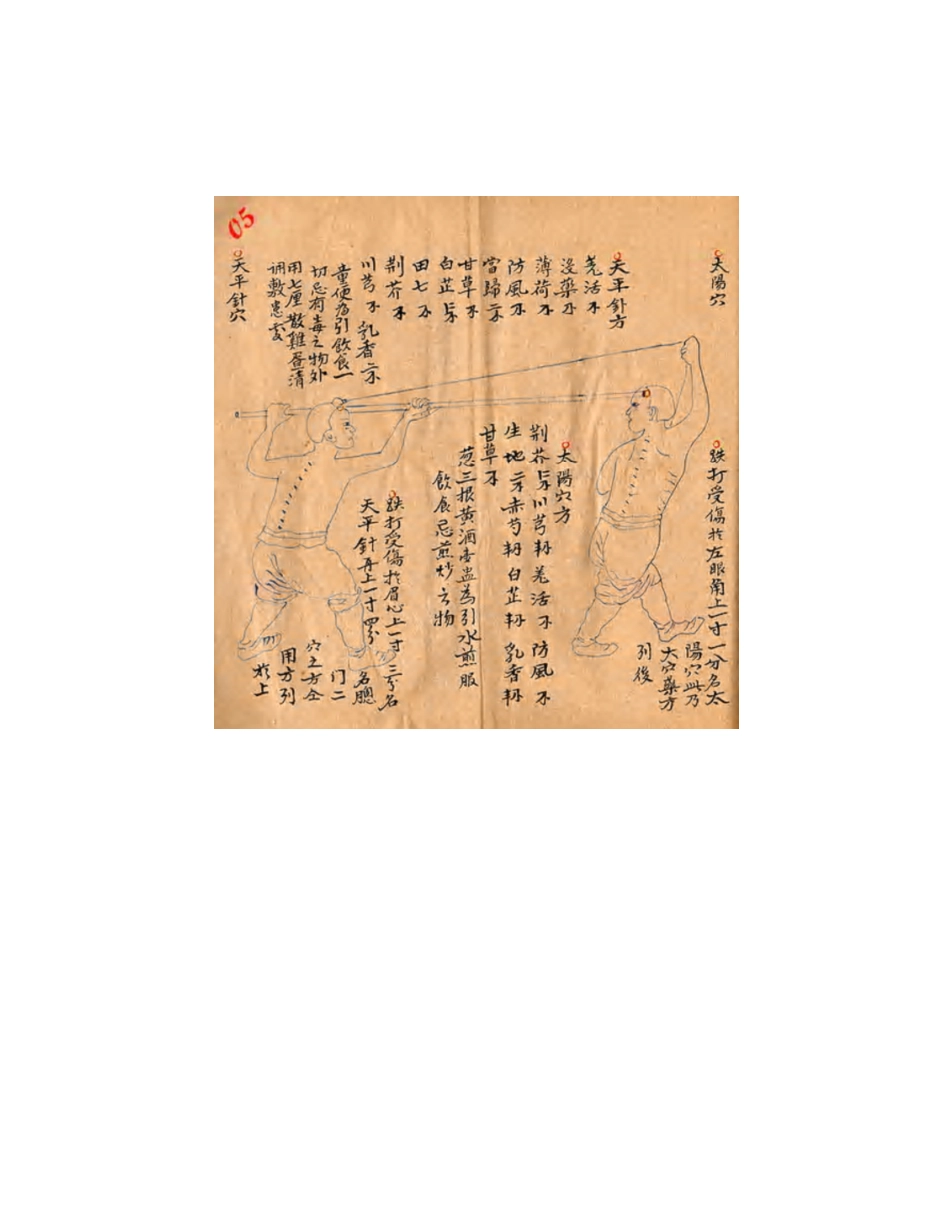 [医学][伤科]- 蘇炎生跌打秘方_19-27.pdf_第2页