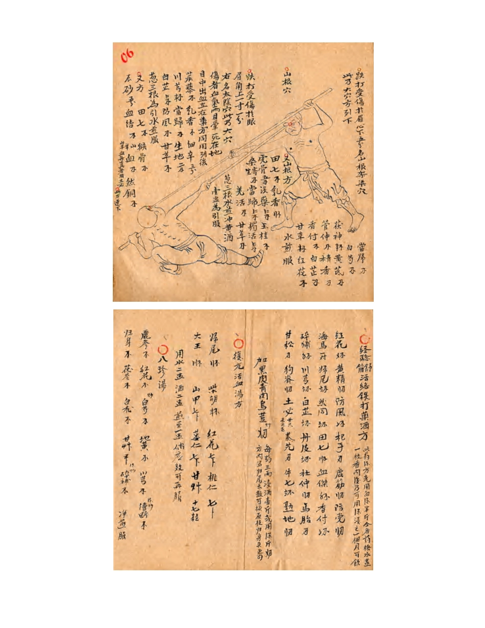 [医学][伤科]- 蘇炎生跌打秘方_19-27.pdf_第3页