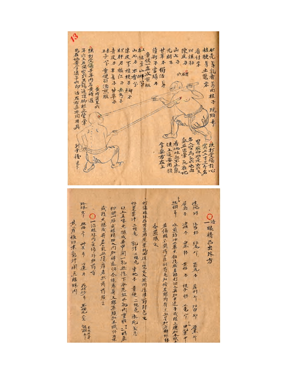 [医学][伤科]- 蘇炎生跌打秘方_28-36.pdf_第1页