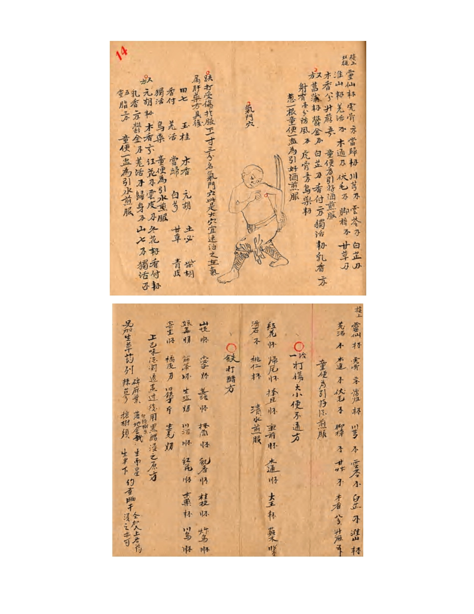 [医学][伤科]- 蘇炎生跌打秘方_28-36.pdf_第2页