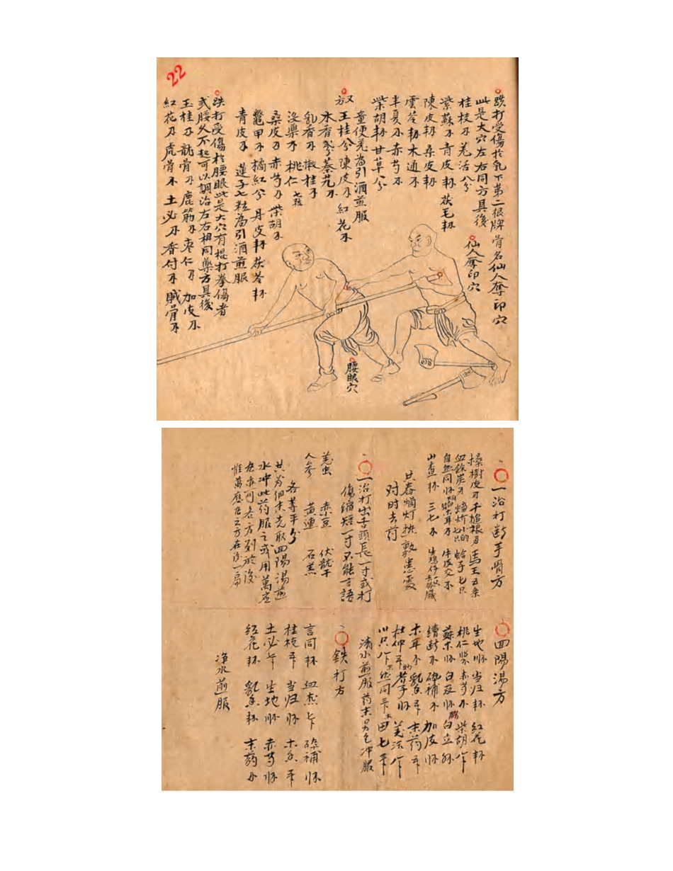 [医学][伤科]- 蘇炎生跌打秘方_37-45.pdf_第1页