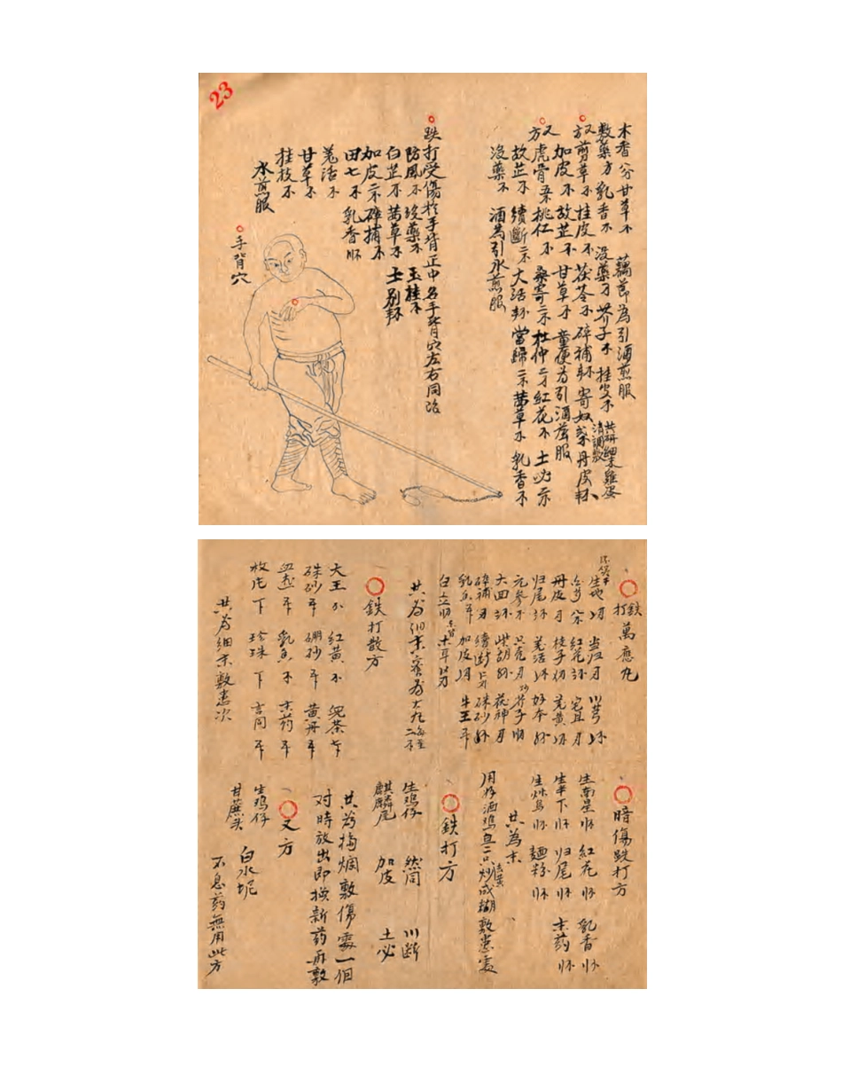 [医学][伤科]- 蘇炎生跌打秘方_37-45.pdf_第2页