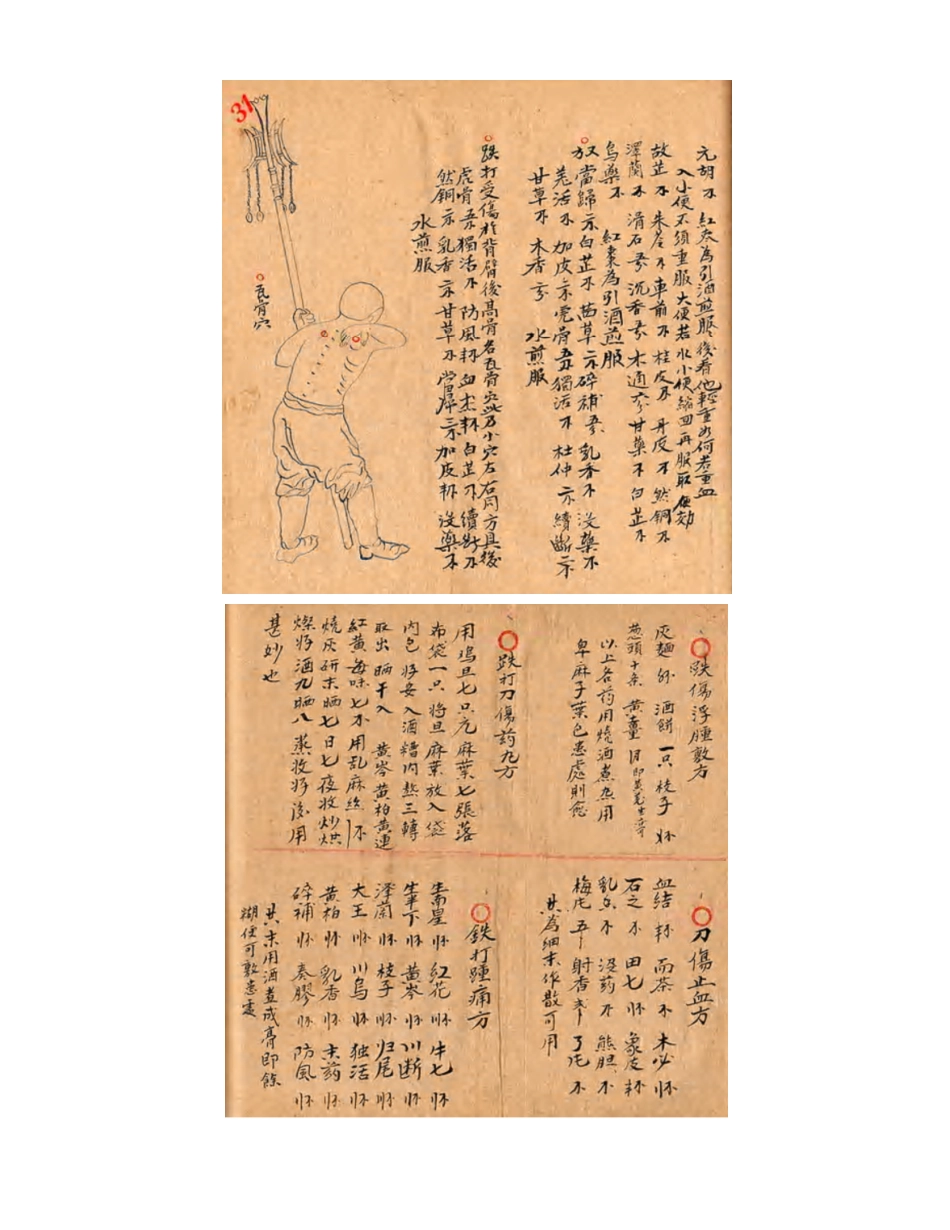 [医学][伤科]- 蘇炎生跌打秘方_46-54.pdf_第1页