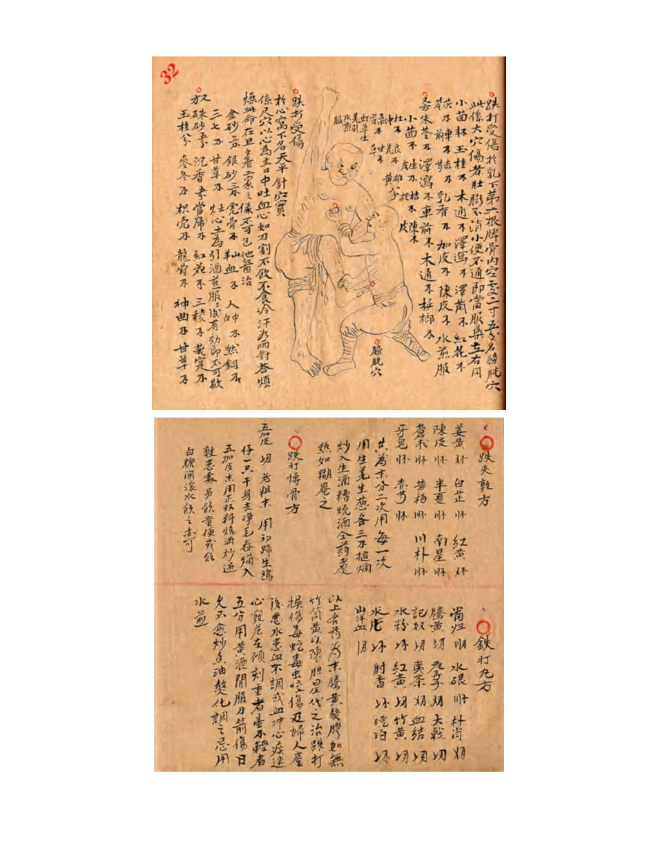 [医学][伤科]- 蘇炎生跌打秘方_46-54.pdf_第2页