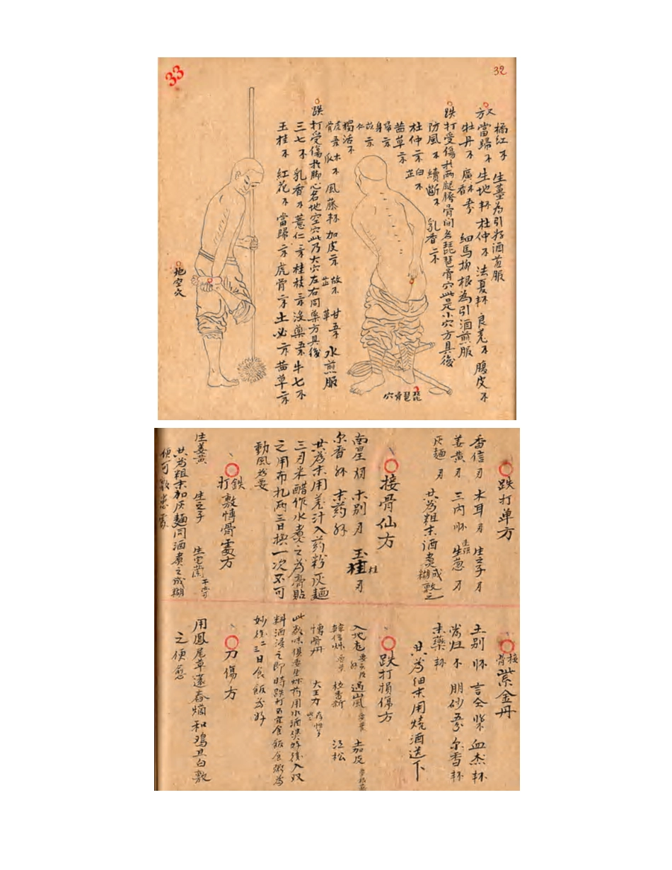 [医学][伤科]- 蘇炎生跌打秘方_46-54.pdf_第3页