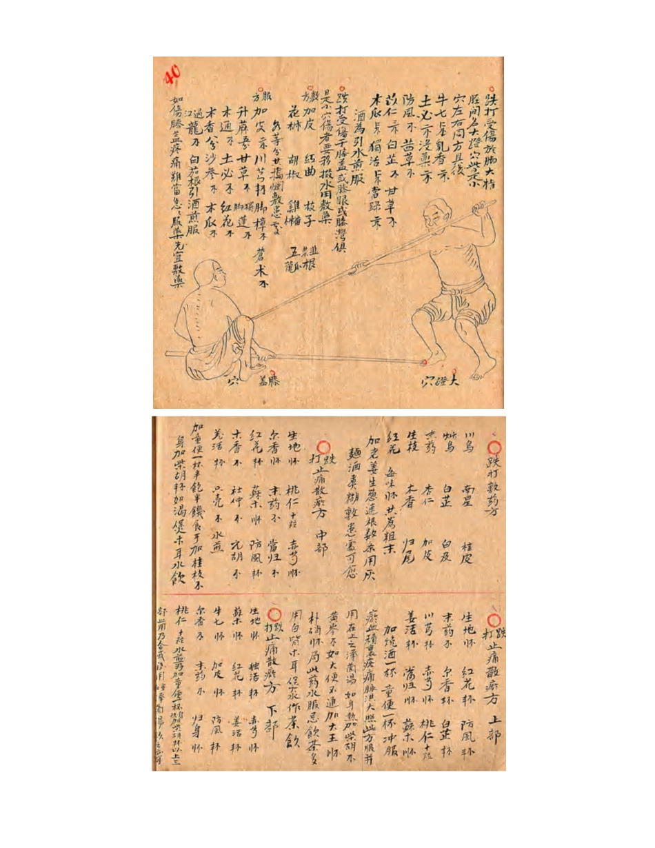[医学][伤科]- 蘇炎生跌打秘方_55-63.pdf_第1页