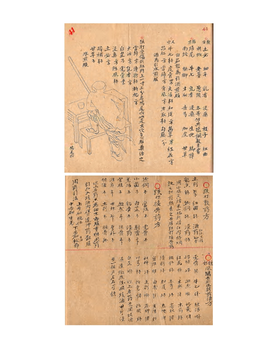 [医学][伤科]- 蘇炎生跌打秘方_55-63.pdf_第2页