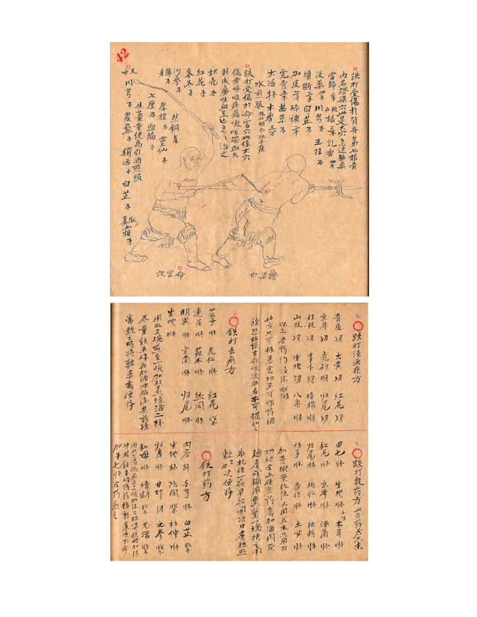 [医学][伤科]- 蘇炎生跌打秘方_55-63.pdf_第3页
