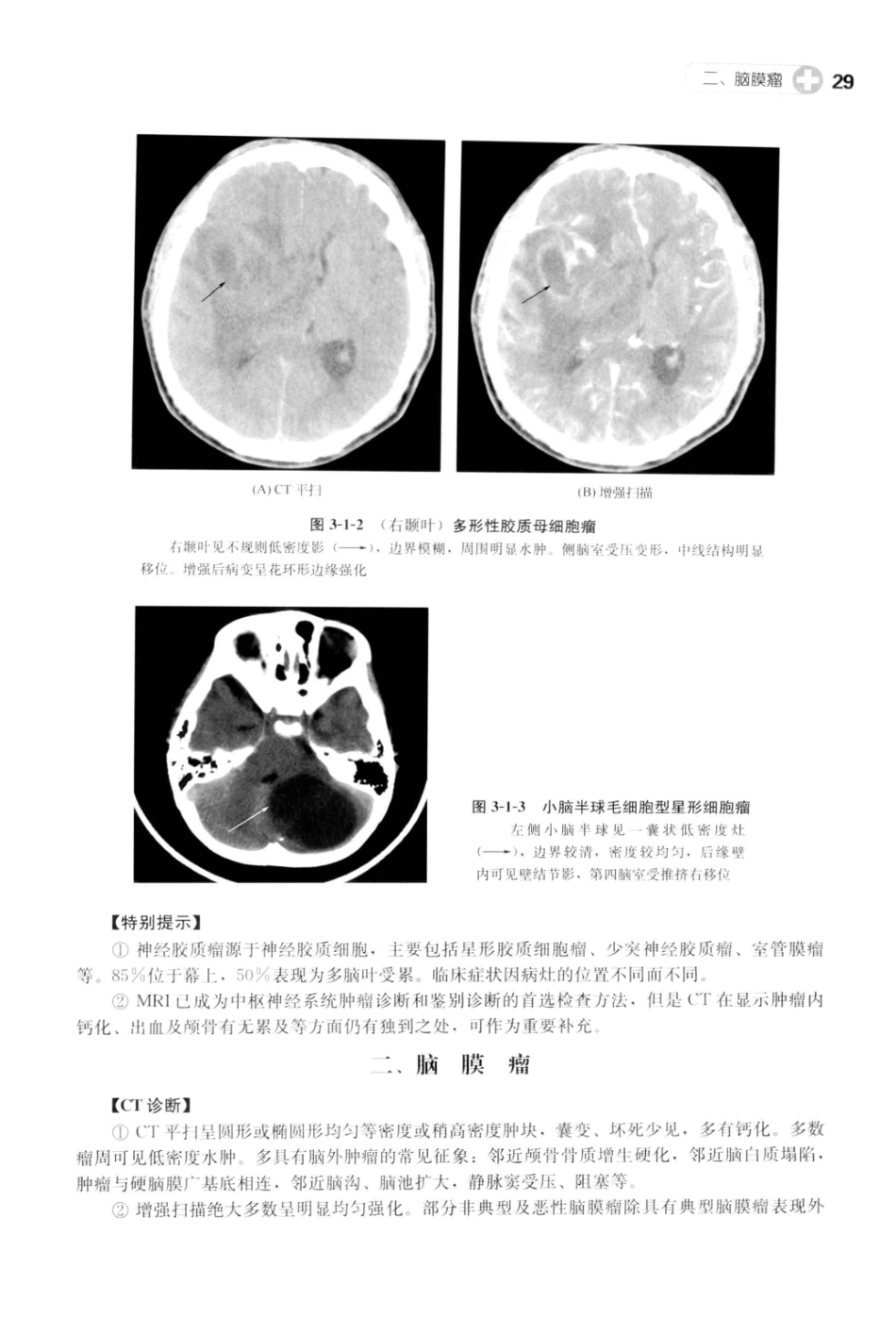 CT读片指南_13200549_42-82.pdf_第1页