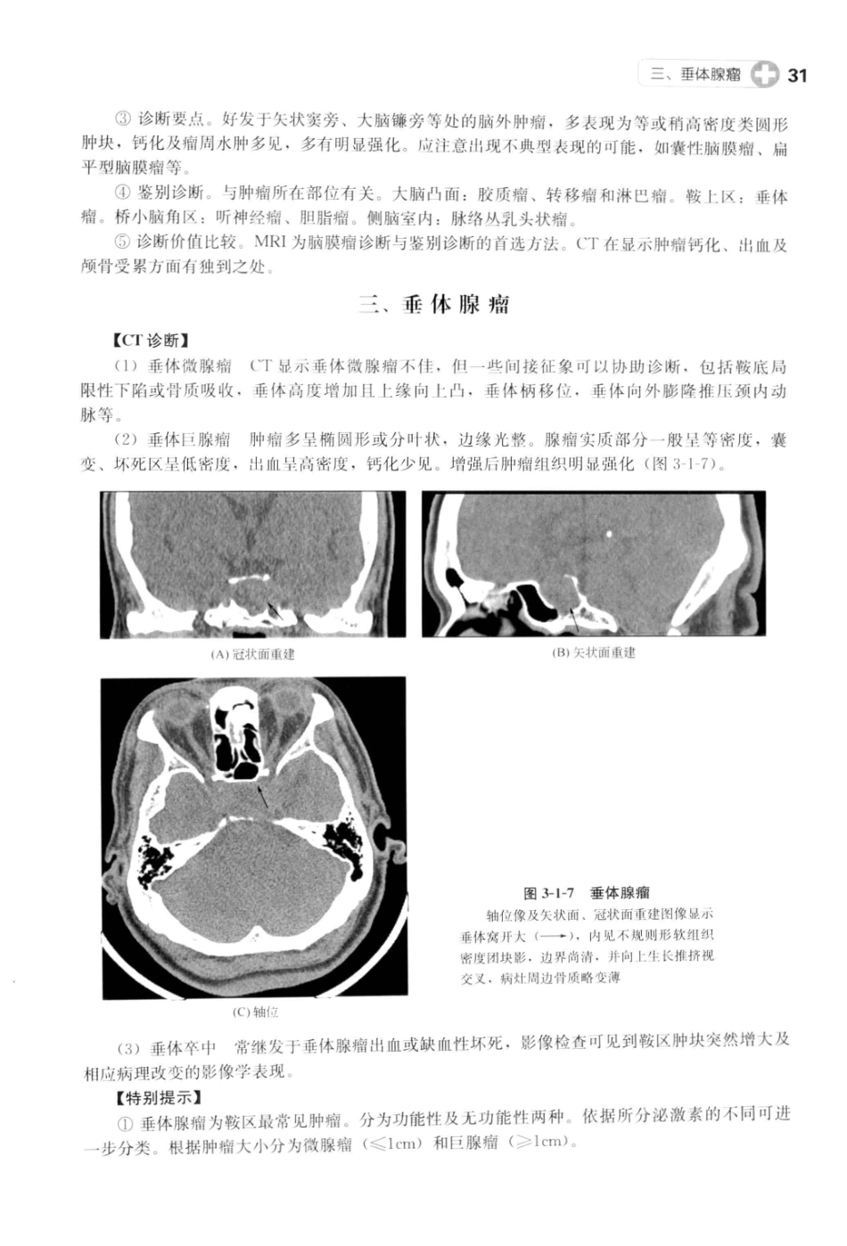 CT读片指南_13200549_42-82.pdf_第3页