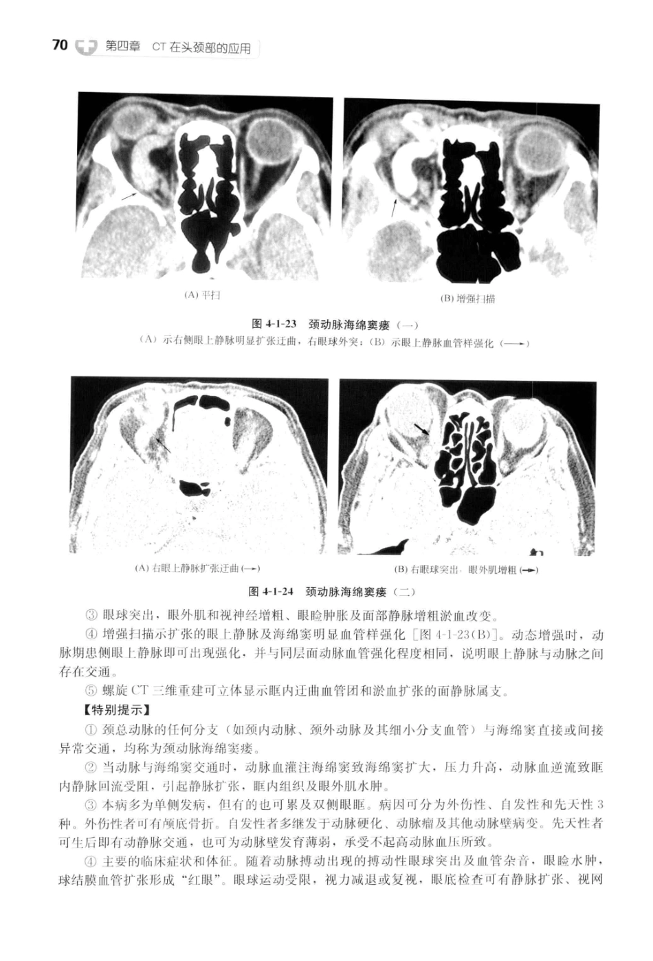 CT读片指南_13200549_83-123.pdf_第1页