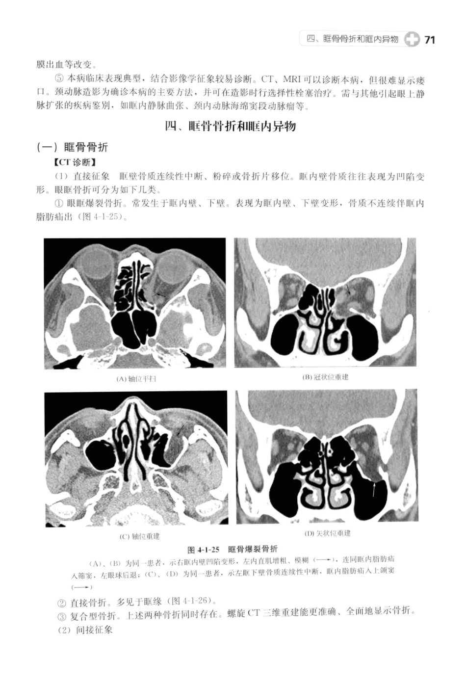 CT读片指南_13200549_83-123.pdf_第2页