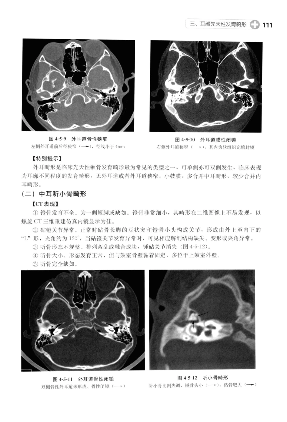 CT读片指南_13200549_124-164.pdf_第1页