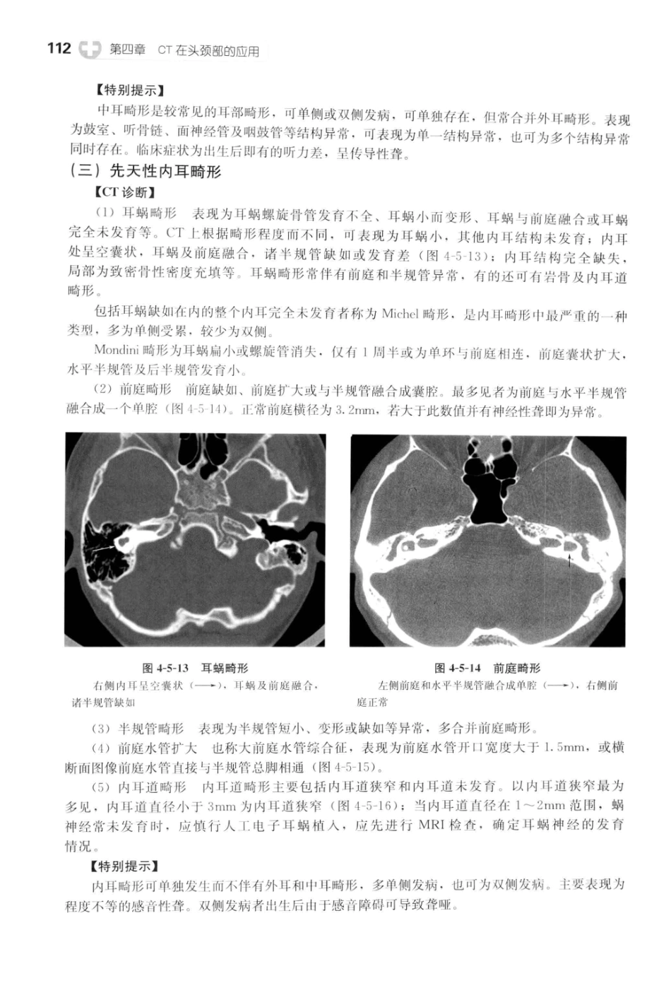 CT读片指南_13200549_124-164.pdf_第2页