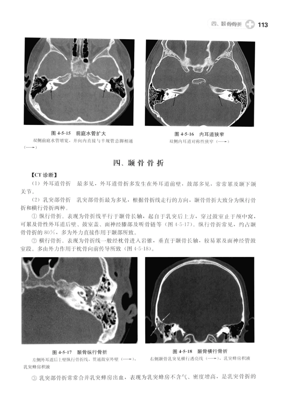CT读片指南_13200549_124-164.pdf_第3页