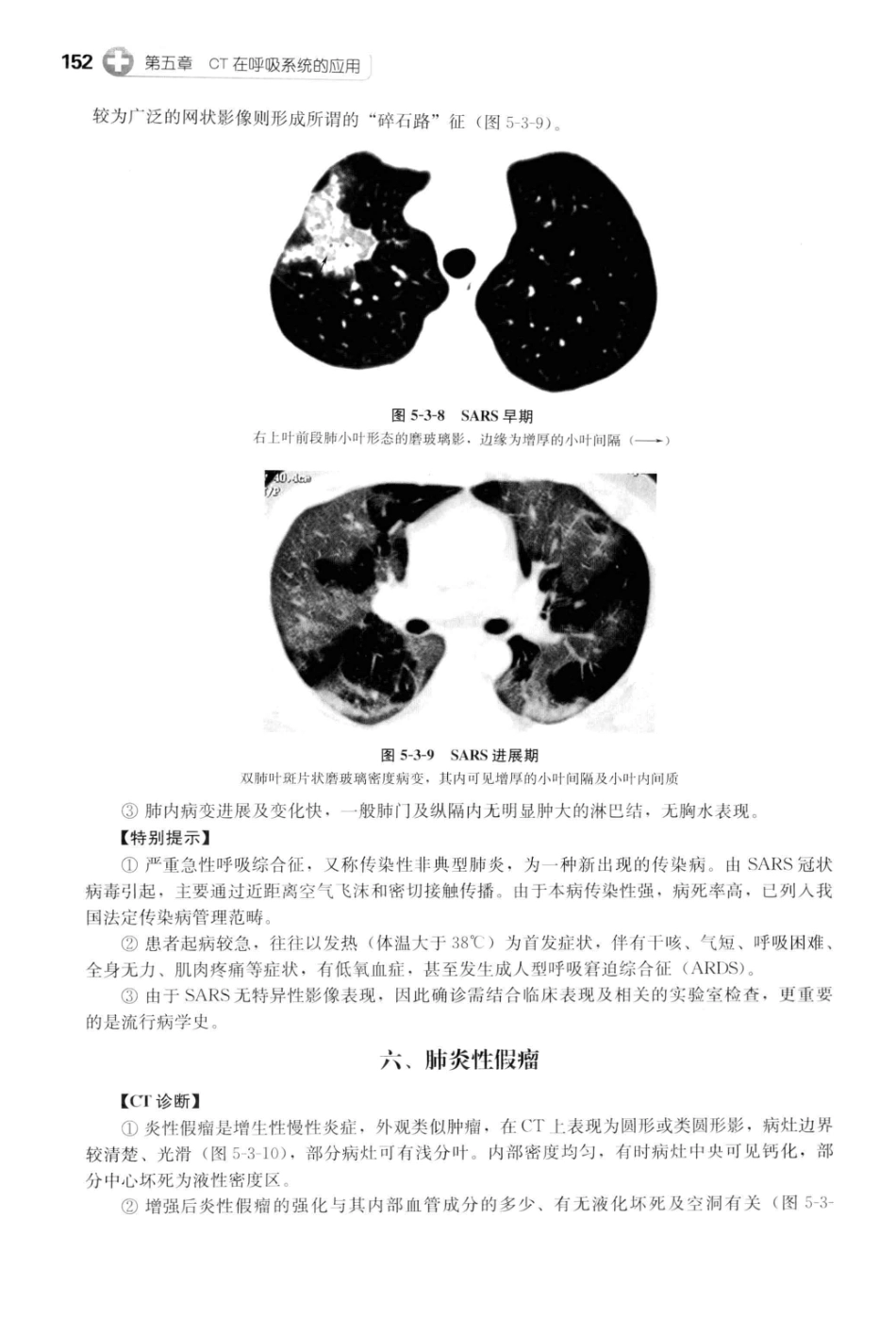 CT读片指南_13200549_165-205.pdf_第1页