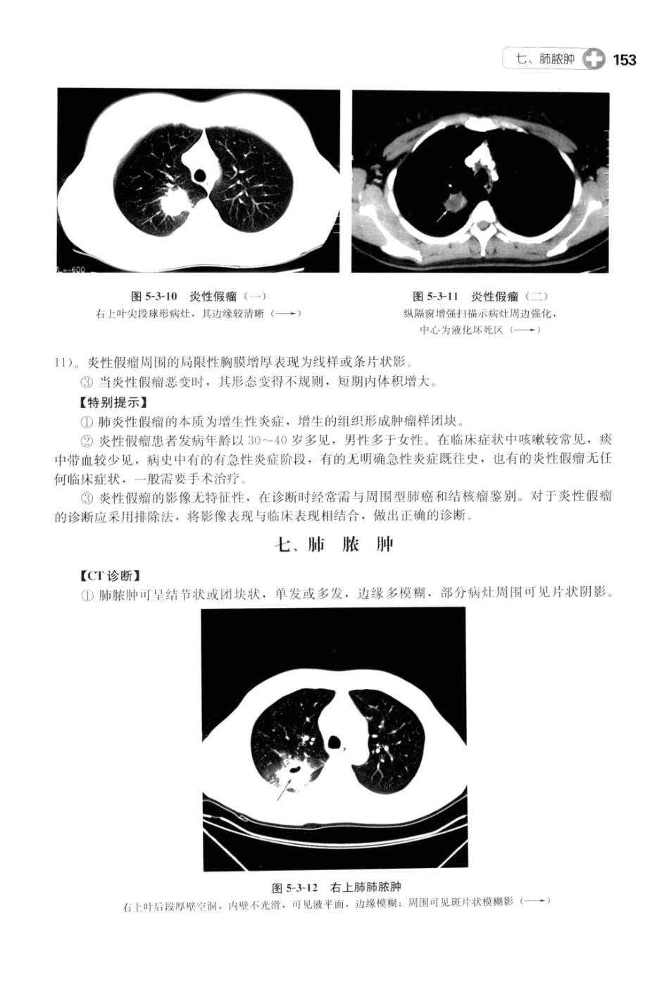 CT读片指南_13200549_165-205.pdf_第2页