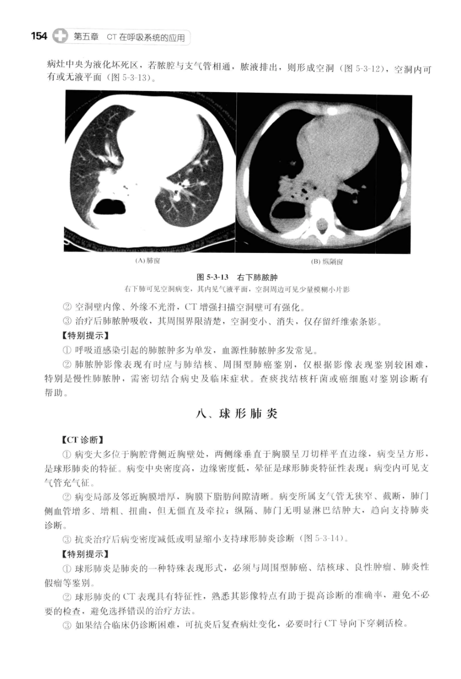 CT读片指南_13200549_165-205.pdf_第3页