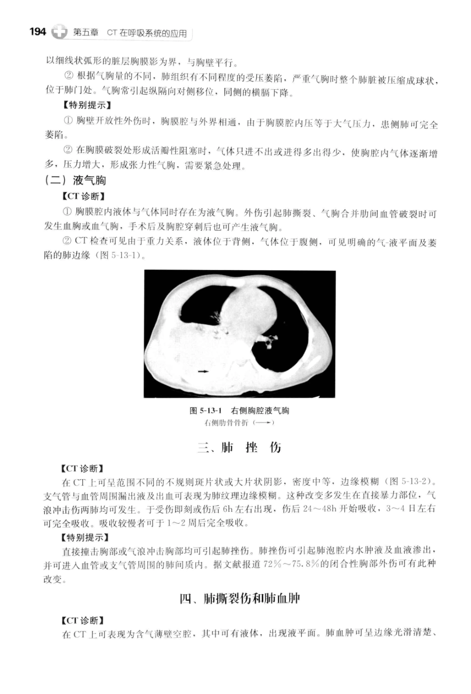 CT读片指南_13200549_206-246.pdf_第2页